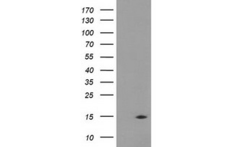 Fitzgerald/CHCHD5 antibody/10R-3678/100 ul