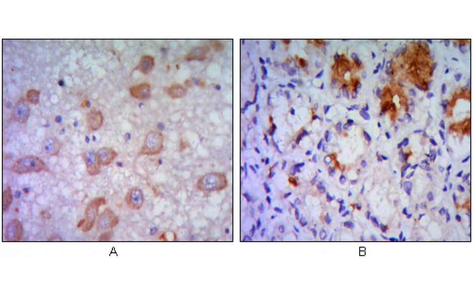 Fitzgerald/ERN1 antibody/10R-2179/100 ul